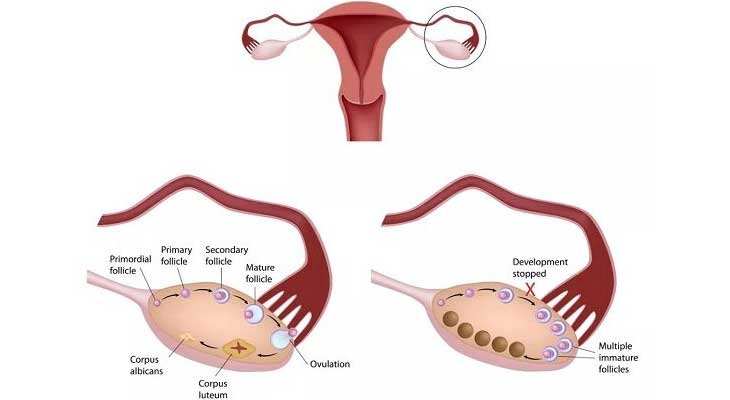 宫腔内框架图