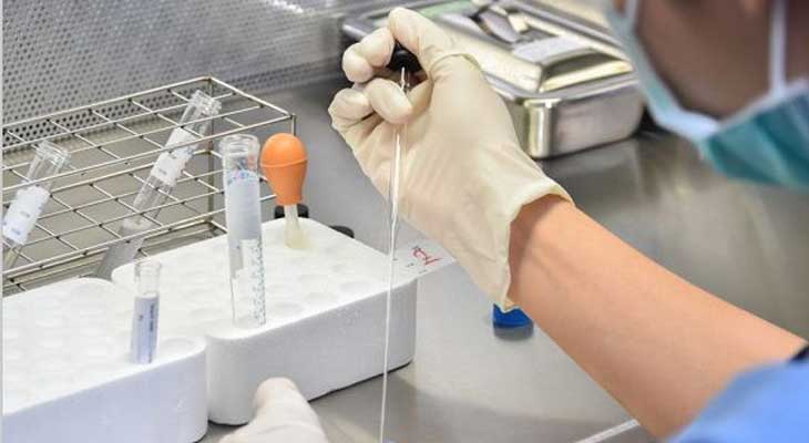 精子基本检查（畸型率 DNA残片）